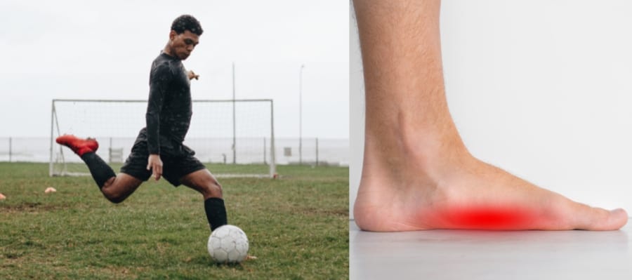 Playing Soccer With Flat Feet